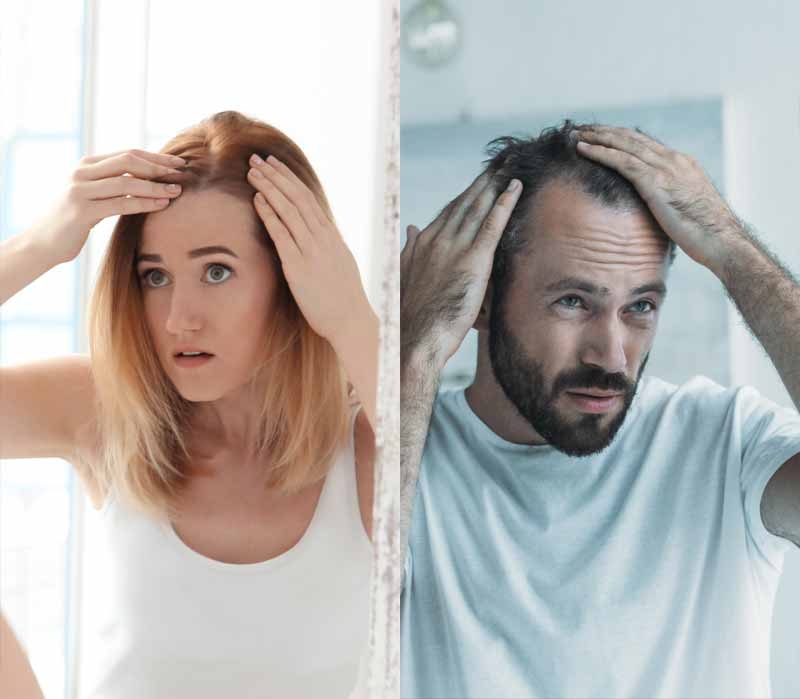 Mittel-gegen-Haarausfall Mittel-gegen-Haarausfall