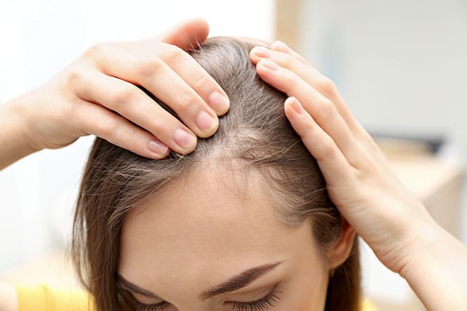 Haarausfall-Frauen Haarausfall