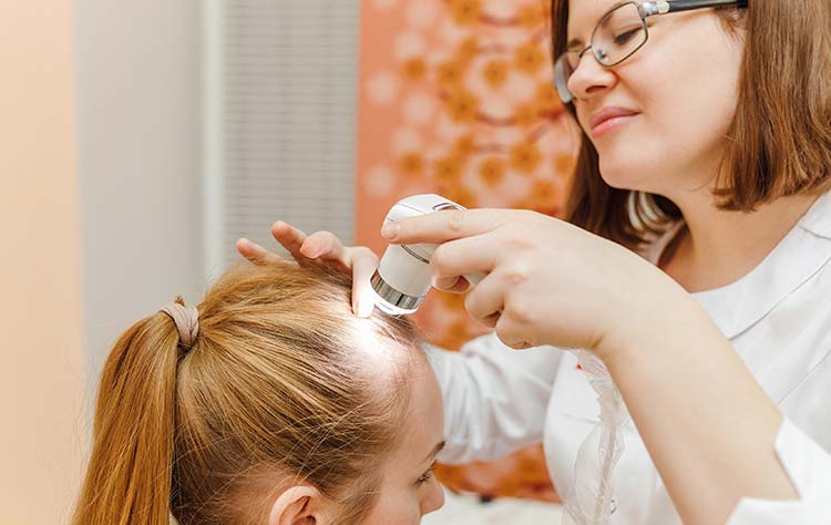 Perdita di capelli donne