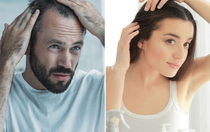 Haarausfall Was Hilft Manner Und Frauen Bei Haarausfall