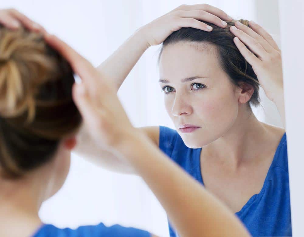 Perdita di capelli donne